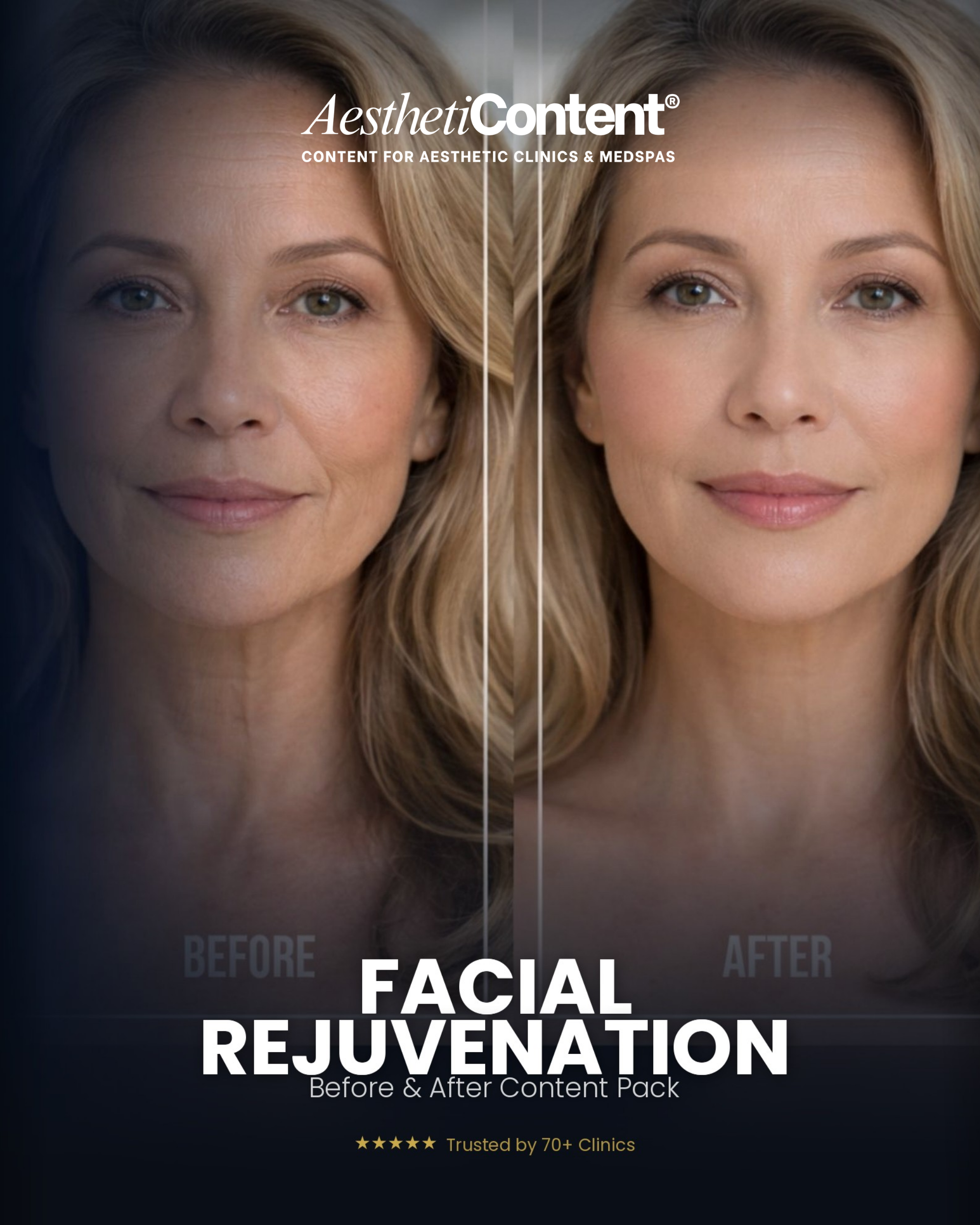 Facial Rejuvenation Before & After Content Pack