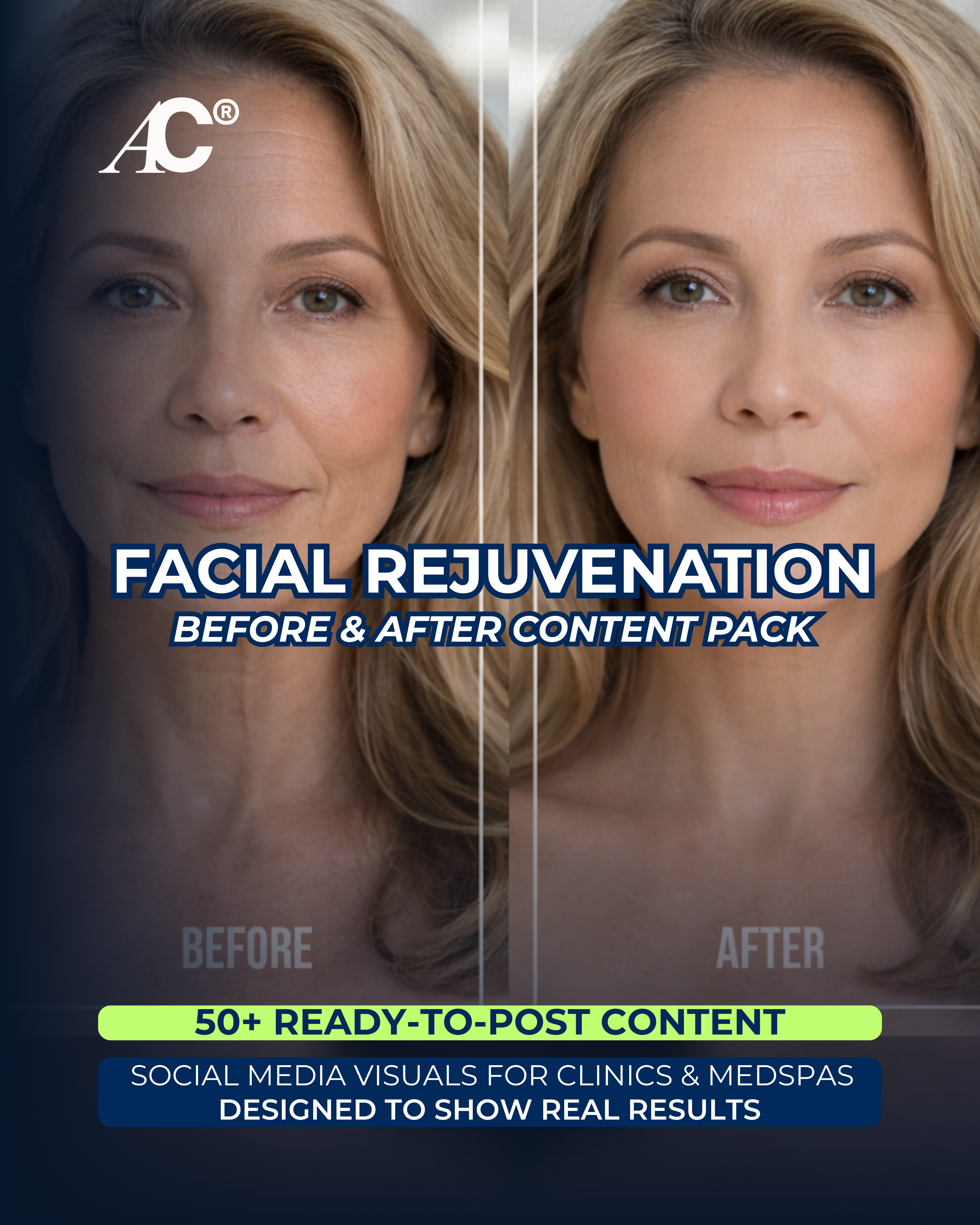 Facial Rejuvenation Before & After Content Pack